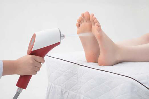 CO₂ Cryotherapy Treatment