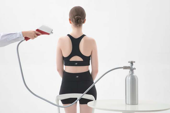 CO₂ Cryotherapy Treatment