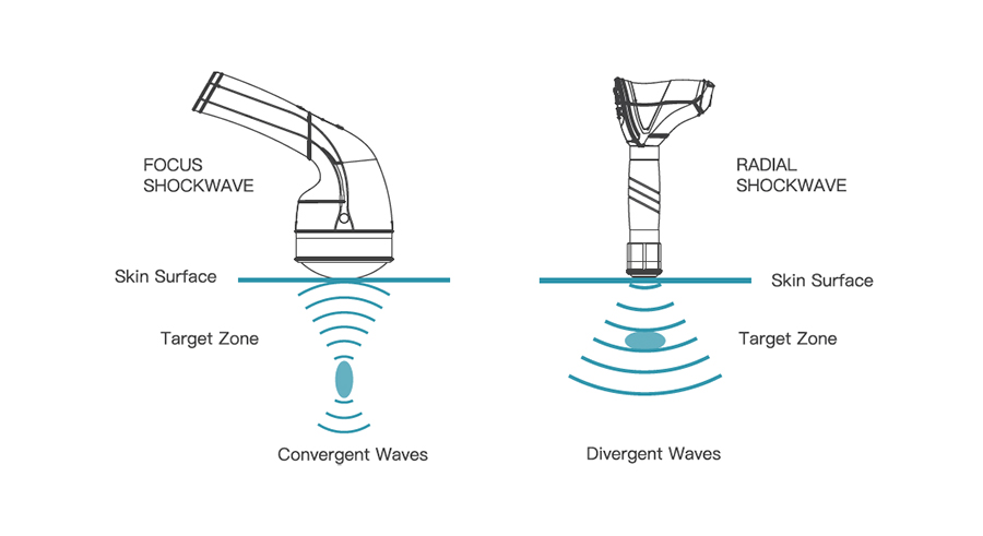 HP - EMFOCUS Shockwave