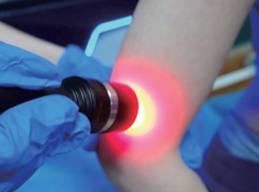 High Power Laser Therapy