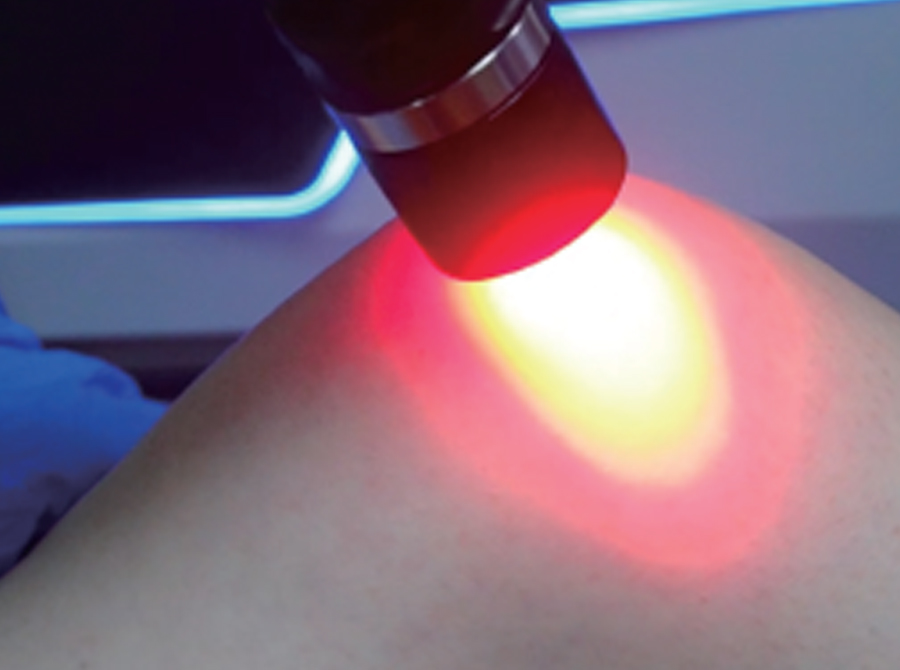 High Power Laser Therapy